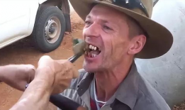 拔牙视频,揭秘拔牙全过程